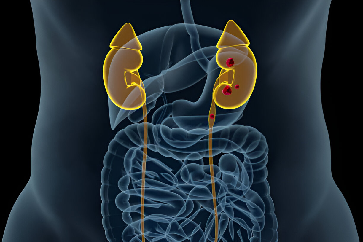 Best Doctor for Kidney Disease In Chembur